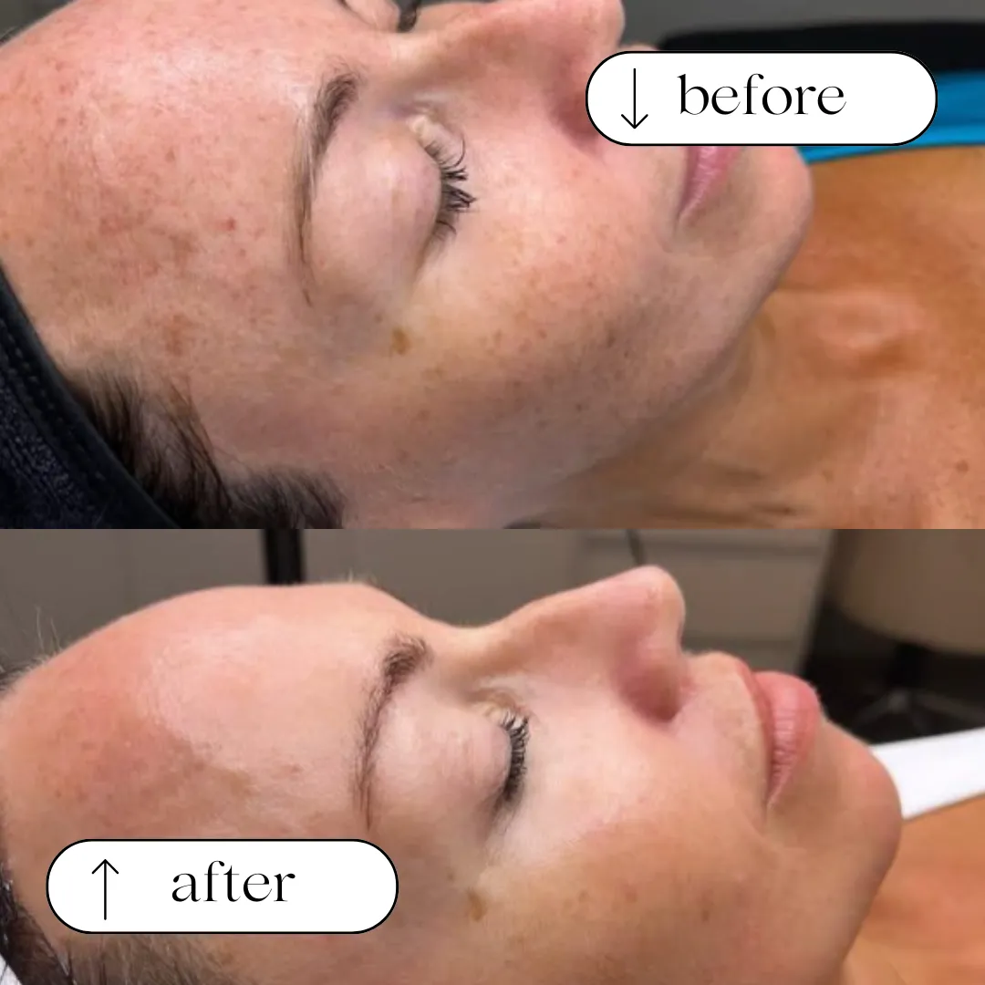 Brightness & Clarity before and after result