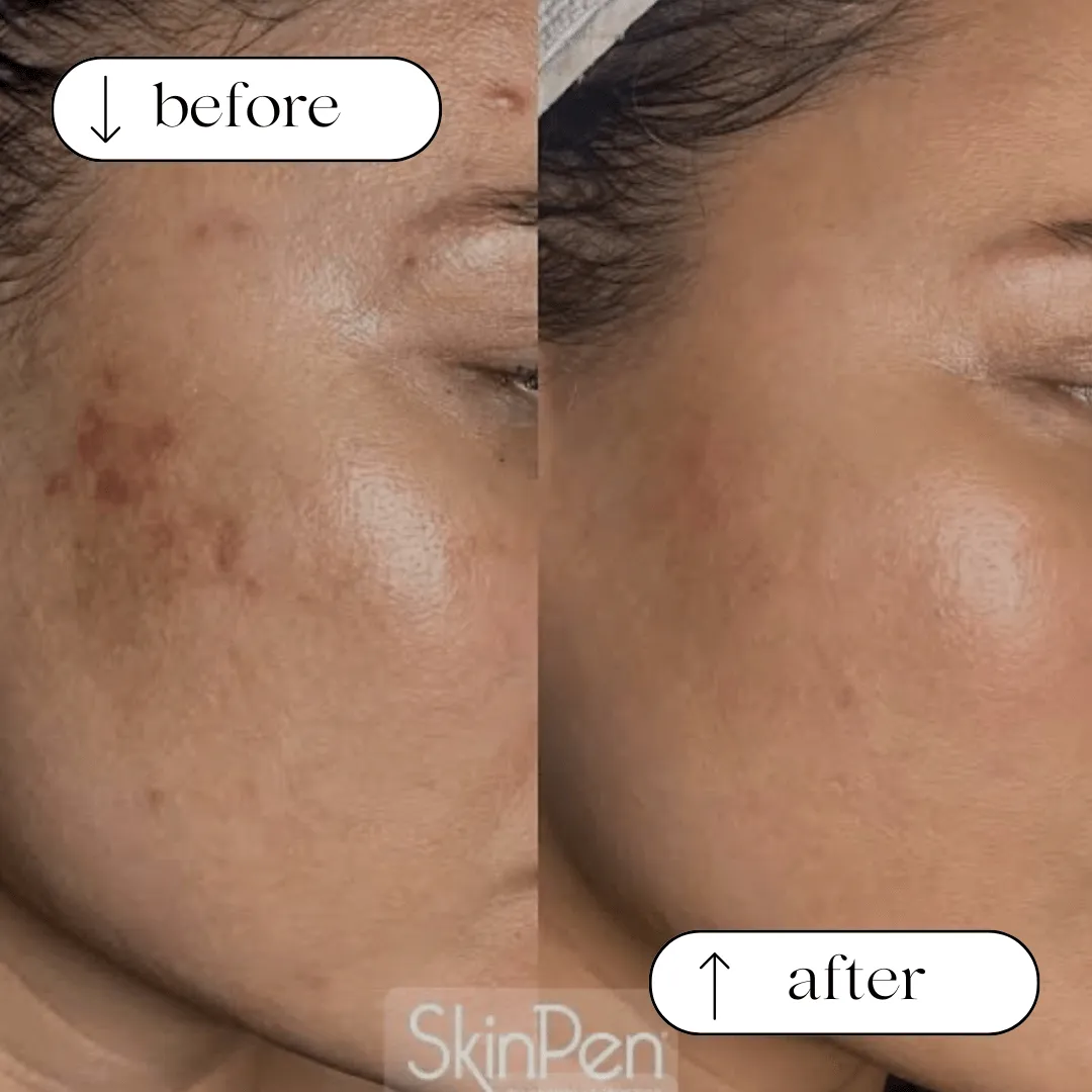Firmer, lit-from-within glow